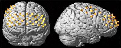 Influence of iTBS on the Acute Neuroplastic Change After BCI Training